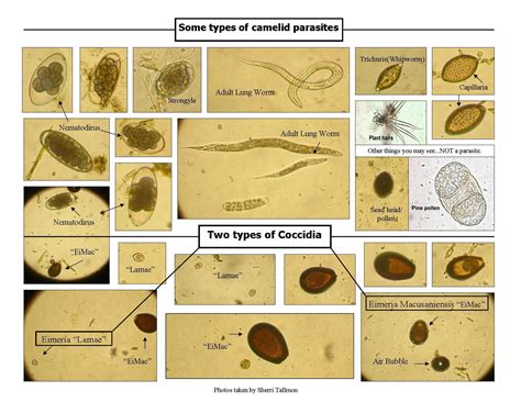 Parasite In Stool Pictures Human