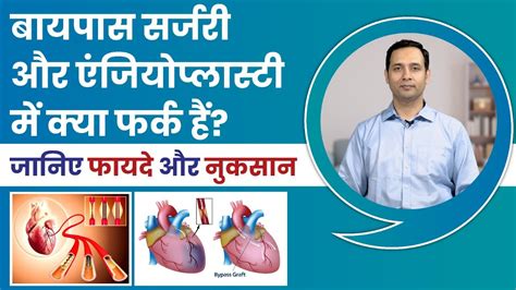 Which Is Better Angioplasty Or Bypass Surgery जानिए फायदे और नुकसान Dr Ashar Khan