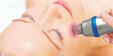 Micro Needle Fractional RF DermaHealth