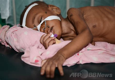 ソマリアの子ども20万人に餓死の恐れ、ユニセフが警鐘 写真1枚 国際ニュース：afpbb News