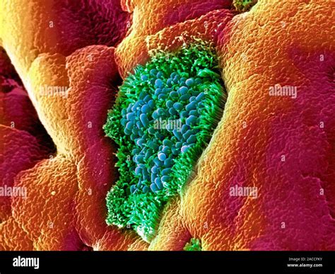 E Coli Bakterien Farbige Scanning Electron Micrograph Sem Von Escherichia Coli Bakterien