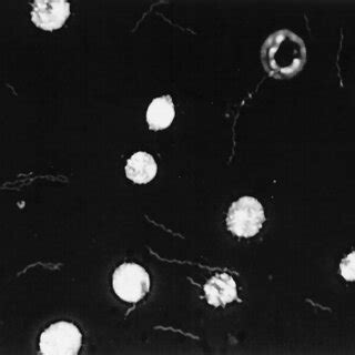 Spirochete-like cells in blood cultures as seen by dark- fi eld... | Download Scientific Diagram