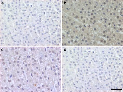 Photomicrographs Of Fos Protein Immunoreactivity In Adrenal Glands