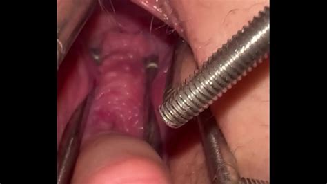 Extreme Pussy Stretching Bokeptube