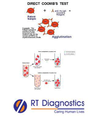 Coombs Direct Rt Diagnostics