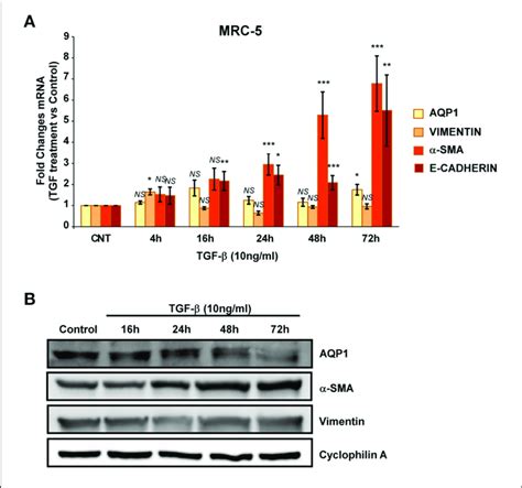 Analysis Of Fibroblast Myofibroblast Transition Induction In Mrc 5