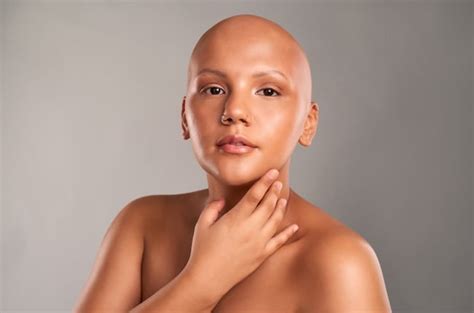 The Bald And The Beautiful Breaking The Stigma Around Female Hair Loss Life