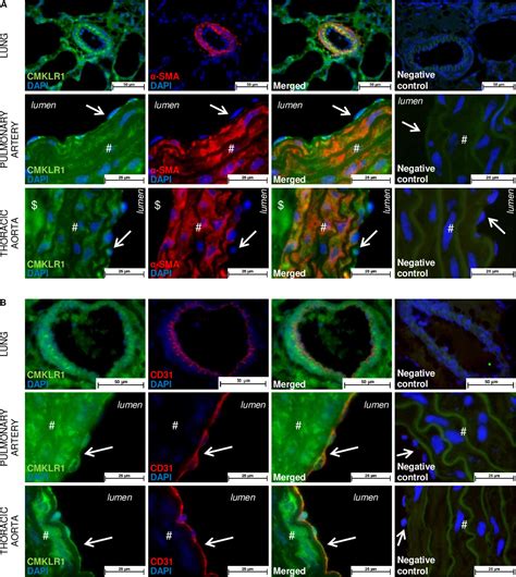 Frontiers Chemerin Added To Endothelin Promotes Rat Pulmonary