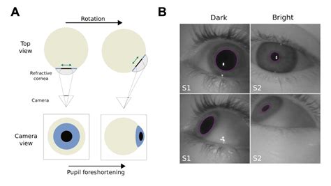 Better Pupillometry Using Corneal Refraction Pupil Labs