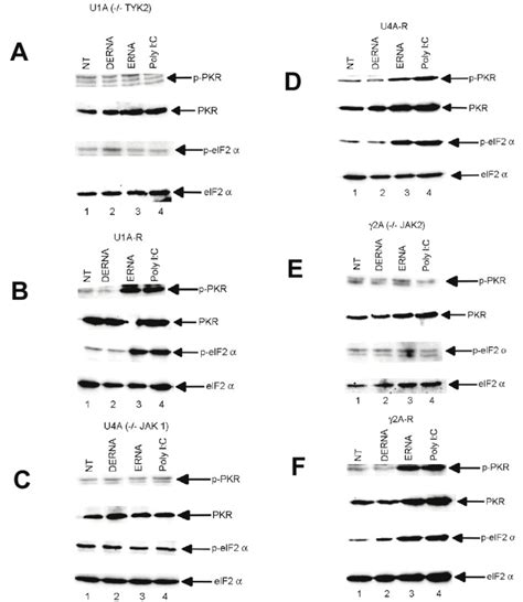 Jak Kinases Are Required For The Bacterial Rna And Poly Ic Induced