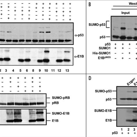 E B K Induces Sumo Modification Of P A H Cells Were