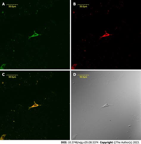 Expression of tyrosine kinase receptor and cholecystokinin-A receptors ...