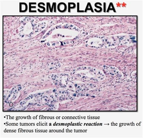 Livergallbladderpancreas Flashcards Quizlet