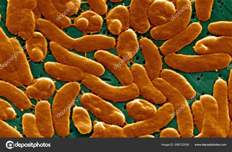 Scanning Electron Micrograph Sem Depicts Grouping Vibrio Vulnificus