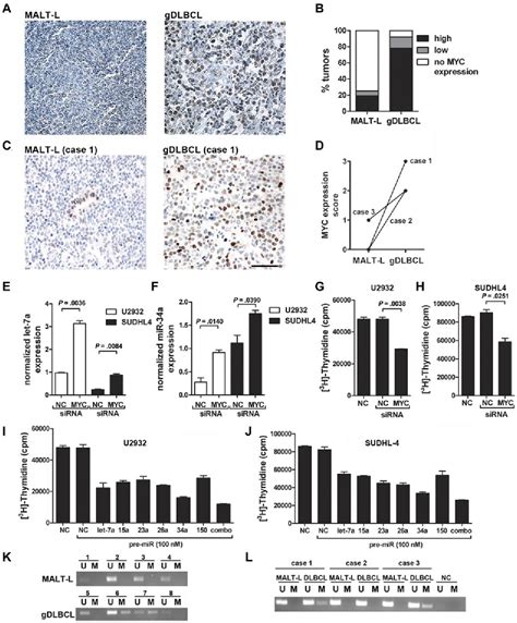 Figure 3 From Myc Mediated Repression Of Microrna 34a Promotes High Grade Transformation Of B