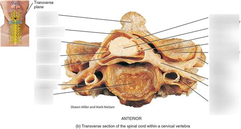 Transverse Section Of The Spinal Cord Within A Cervical Vertebra