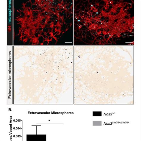 Decreased Leakage From Retinal Vascular Tufts After Single Dose L Nmma