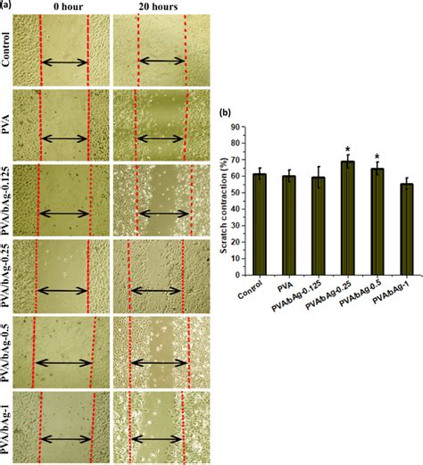 In Vitro Wound Healing Assay Using Hacat Cells A Microscopic Images