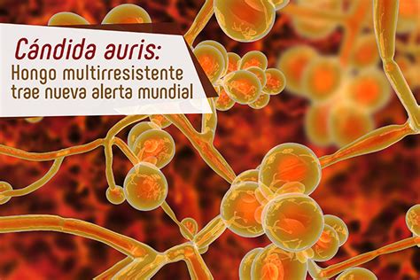 Candida Auris Hongo Multirresistente Trae Nueva Alerta Mundial Blog