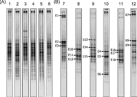 16s Rrna Gene Based Pcr Denaturing Gradient Gel Electrophoresis Dgge Download Scientific