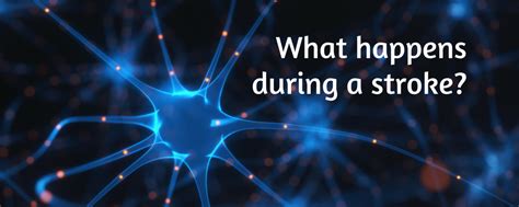 What Happens During A Stroke Thumper Massager