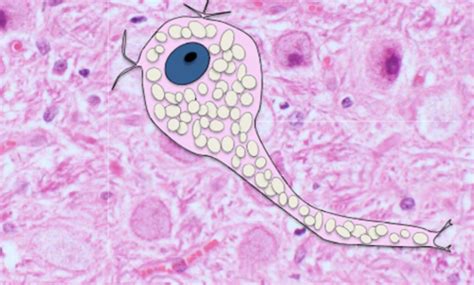 Systemic Pathology Exam Flashcards Quizlet