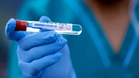 Coronavirus Monitoraggio Settimanale L Analisi Della Cabina Di Regia