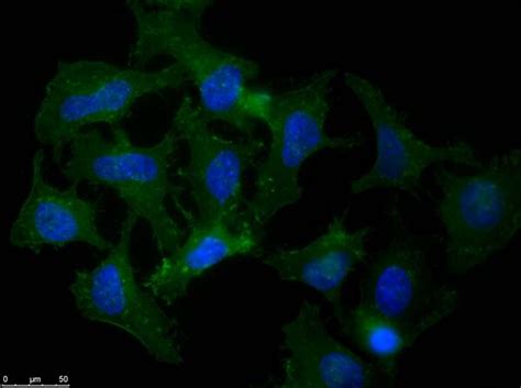 beta Amyloid antibody (ab2539) | Abcam