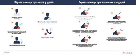 Первая помощь при ожогах кипятком в домашних условиях — Российско ...