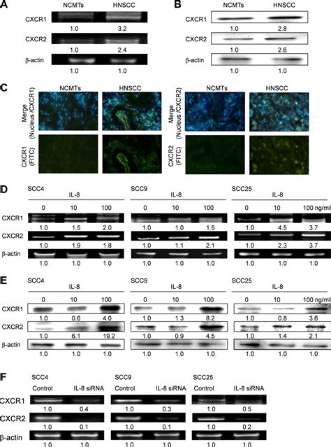 Il 8 Signals Through Cxcr1 And Cxcr2 In Hnscc A Levels Of Cxcr1 And