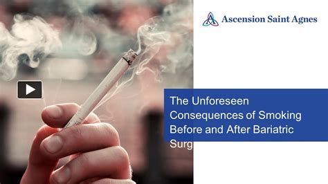 Ppt Discover The Hidden Dangers Of Smoking Before And After Bariatric