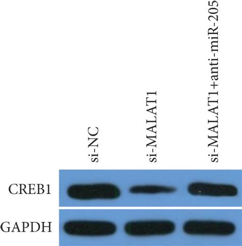 Malat Exerts A Biological Role In Mgcs By Regulating The Mir Creb