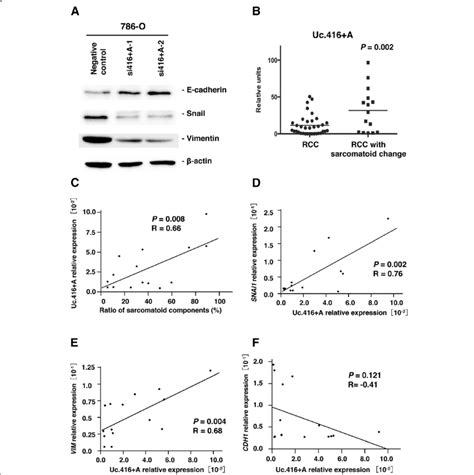 Uc416 A Modulates Epithelial To Mesenchymal Transition A Western