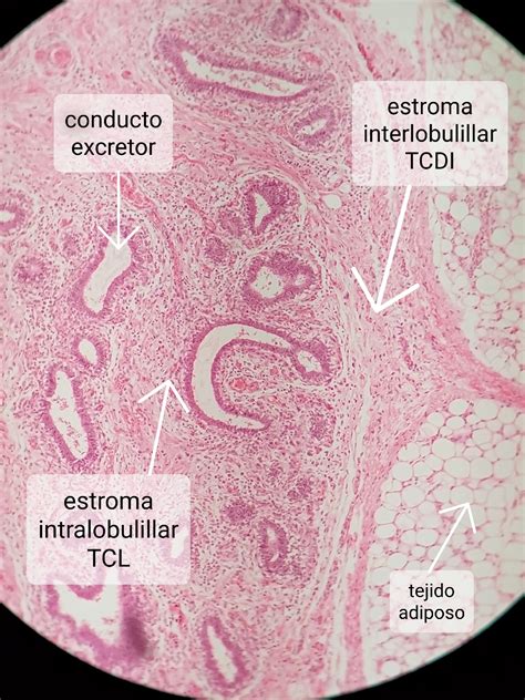 Tp Histolog A De Mam Y Pr Stata Cuello Uterino