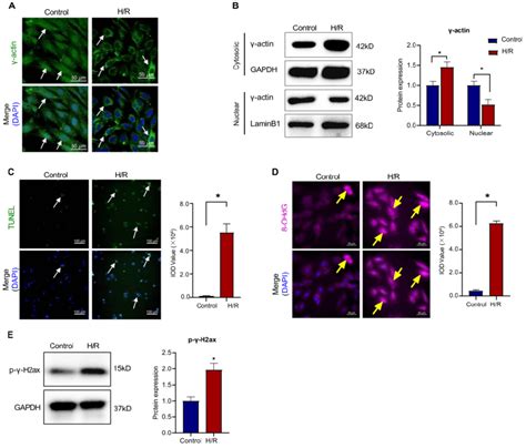 Intracellular Localization Of γ Actin And Dna Damage In H9c2 Cell