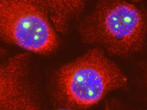 What is the Difference Between SMN1 and SMN2 Gene | Compare the ...