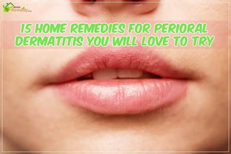 15 Home Remedies For Perioral Dermatitis You Should Try Home Remedies