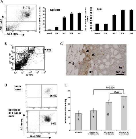 Abrogation of TGFβ Signaling in Mammary Carcinomas Recruits Gr 1 CD11b