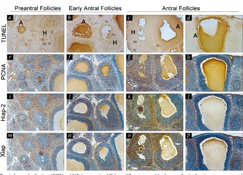 Figure 1 From Expression Of Inhibitor Of Apoptosis Proteins IAPs In