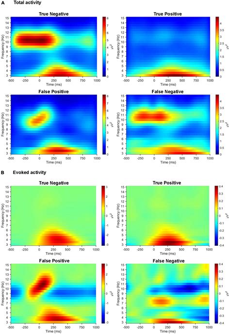 Frontiers Deep Learning Based Electroencephalic Diagnosis Of Tinnitus