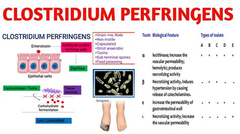 Clostridium Perfringens Gas Gangrene Medical Microbiology Youtube