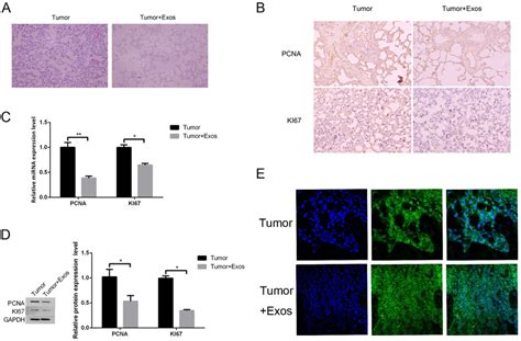 M Exos I Nhibits Tumor Cell Growth In Vivo A Observation Of Mouse