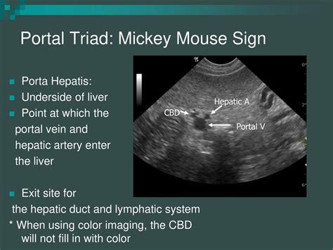 Lackawanna College Diagnostic Medical Sonography Program Ppt Download