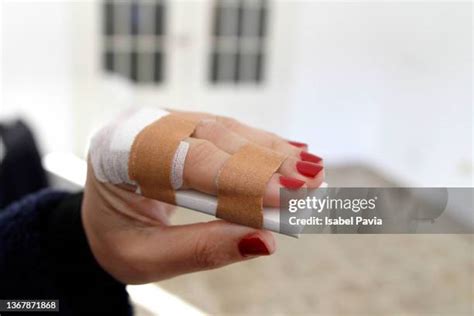 Broken Finger Recovery Photos and Premium High Res Pictures - Getty Images