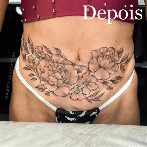 10 Best Hysterectomy Scar Tattoo Ideas That Will Blow Your Mind