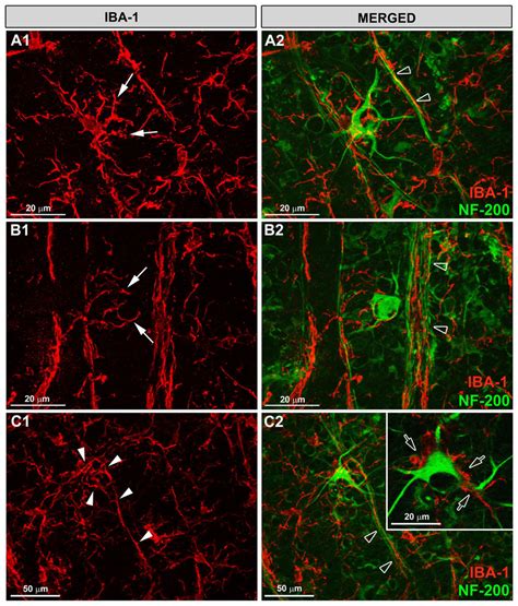 Rod Microglia Sent Processes To Nf Rgcs Somas And Dendrites Iba