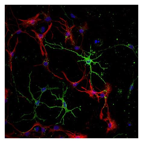 Confocal Microscopy Image Of Astrocytes And Oligodendrocytes Obtained