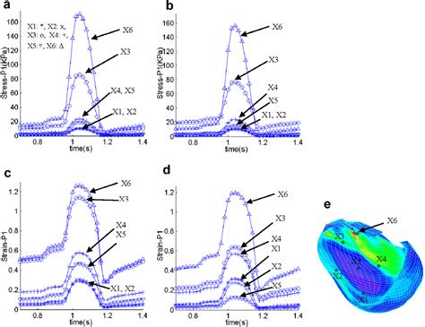 Figure 1 From In Vivo MRI Based 3D FSI RV LV Models For Human Right