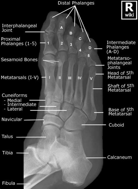 Foot Radiographic Anatomy Wikiradiography Radiology Student