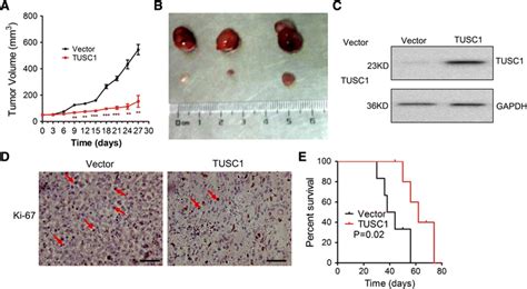 TUSC1 Inhibits GBM Cell Growth In Vivo Ab Tumor Volume Of U251